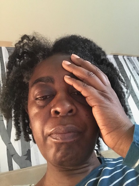 Person with medium hair holding their head with one hand, wearing a blue and white striped top, with grey and white background.