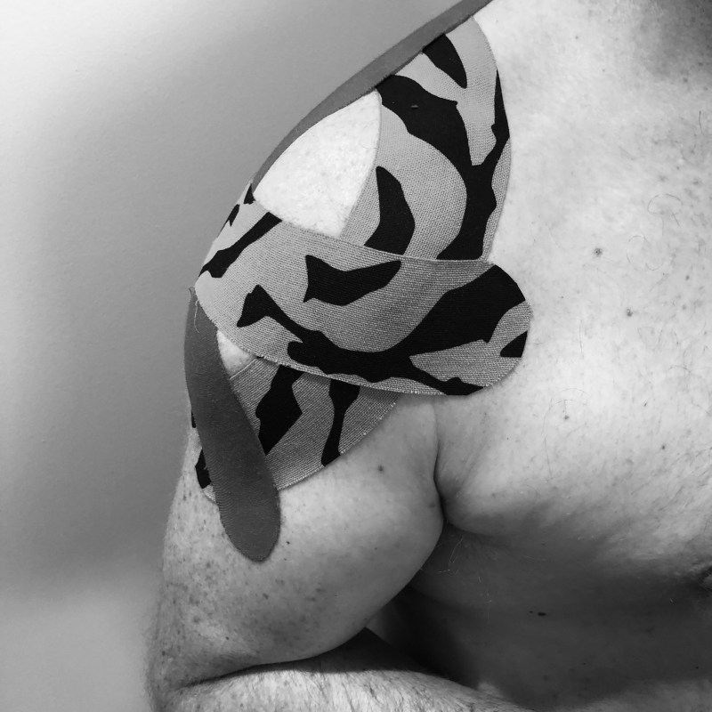 Black and white image of a person’s shoulder and partial view of their arm and torso. The shoulder has been taped up with patterned physiotherapy tape.